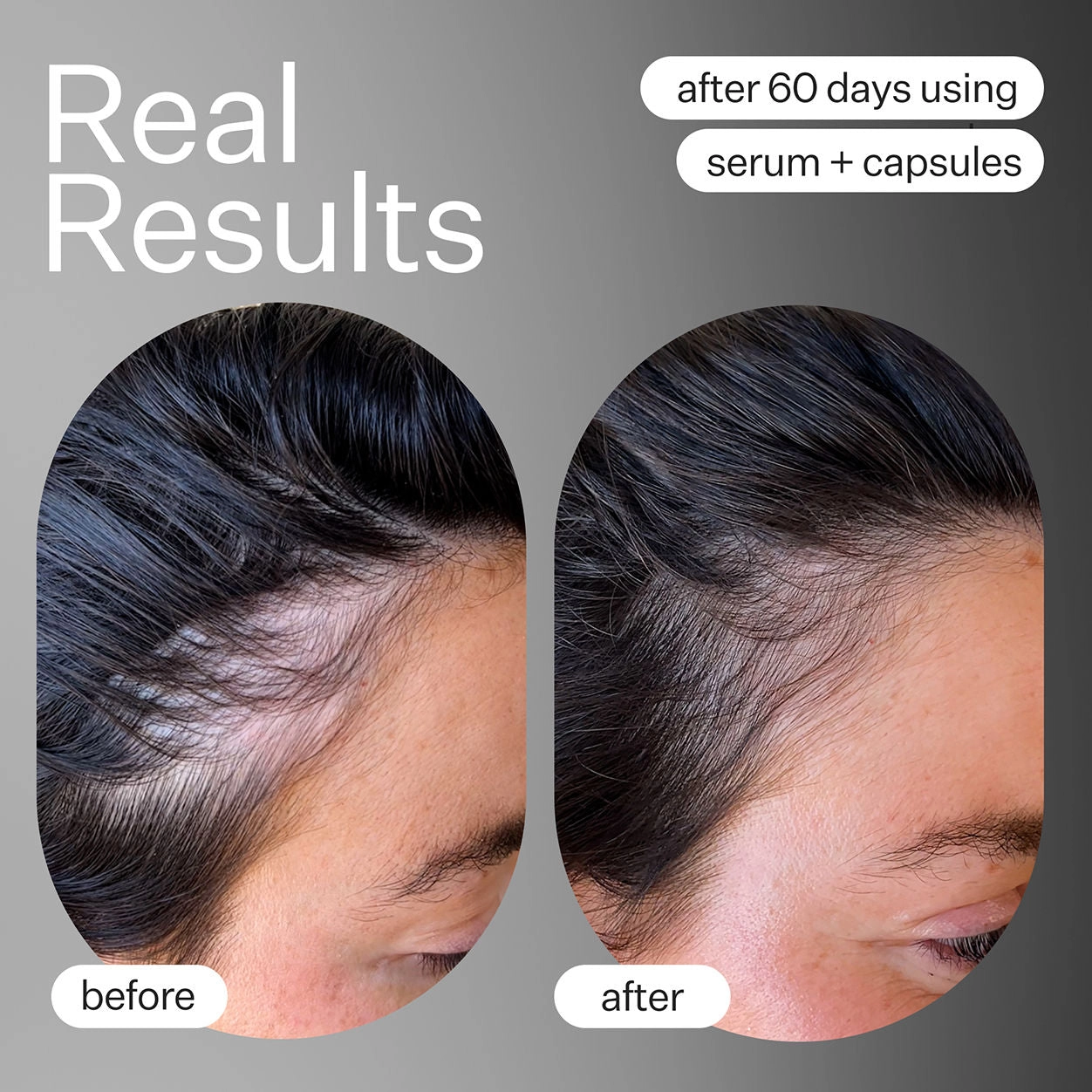 Advanced Fuller Hair System
