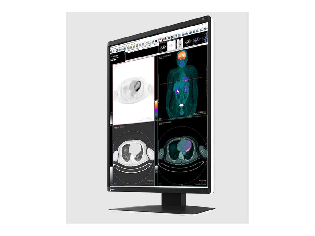 EIZO RadiForce RX370 - LED monitor - 3MP - color - 21.3 - 1536 x 2048 - IPS - 1100 cd/mï¿½ - 1800:1 - 25 ms - DVI-D RX370-BK-SG