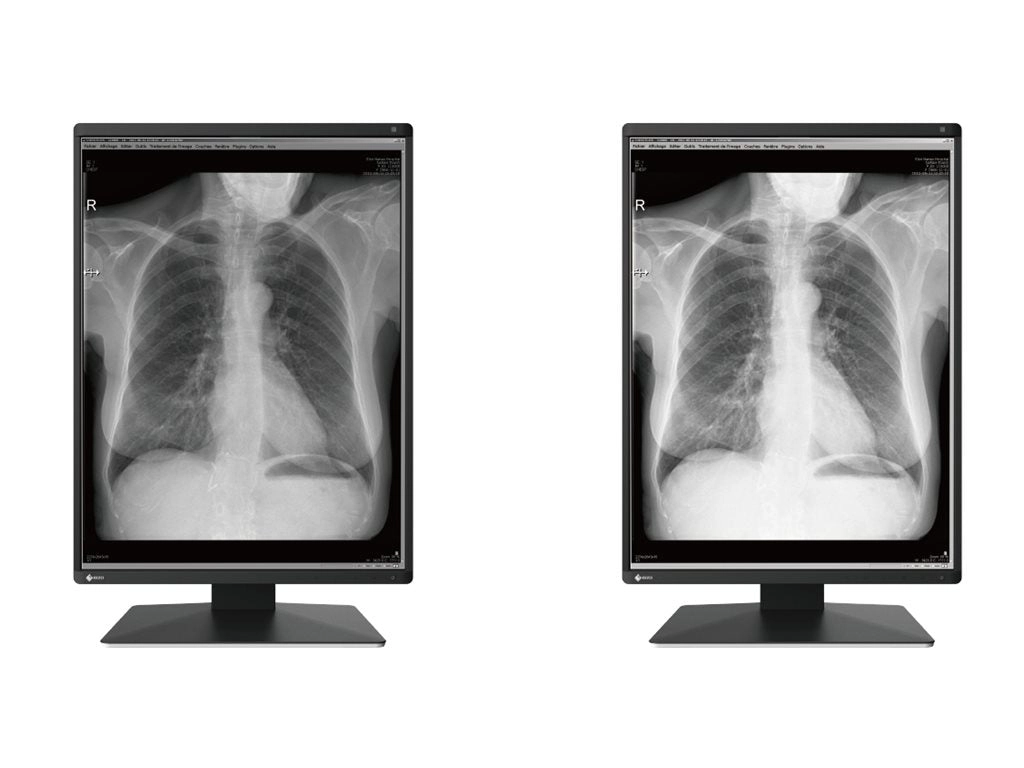 EIZO RadiForce RX370 - LED monitor - 3MP - color - 21.3 - 1536 x 2048 - IPS - 1100 cd/mï¿½ - 1800:1 - 25 ms - DVI-D RX370-BK-SG